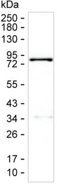 TGM2
